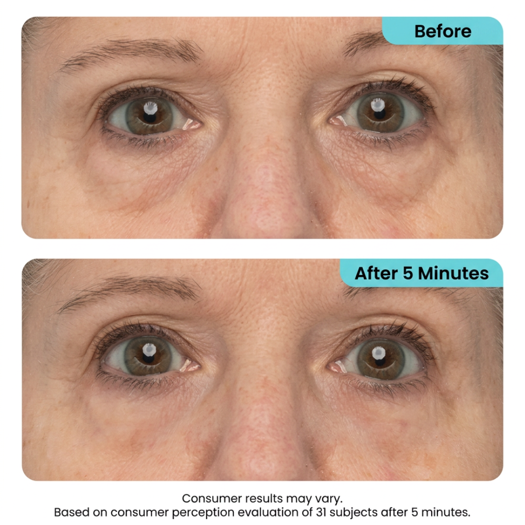 Instant Lift Eye Gel